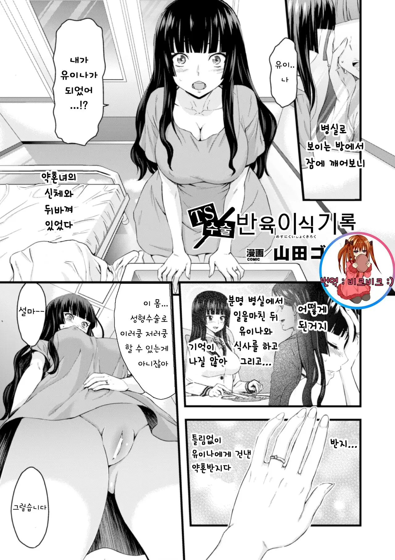 TS 수술 여성 이식 기록